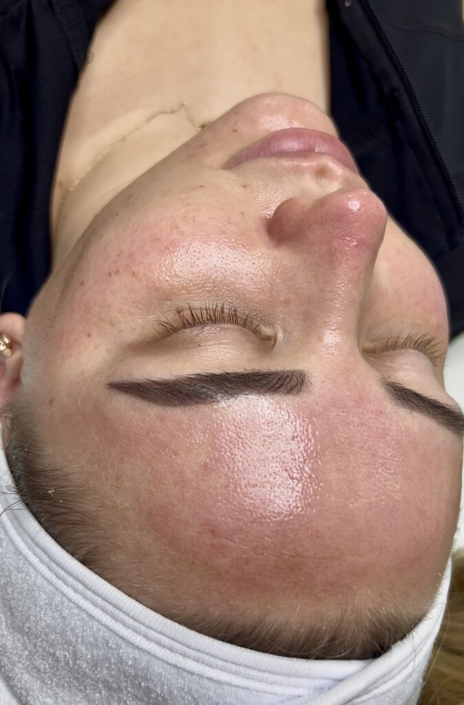 IMG 8578 Anelle Aesthetics Launches Exclusive Corporate Packages in Colmore Business District