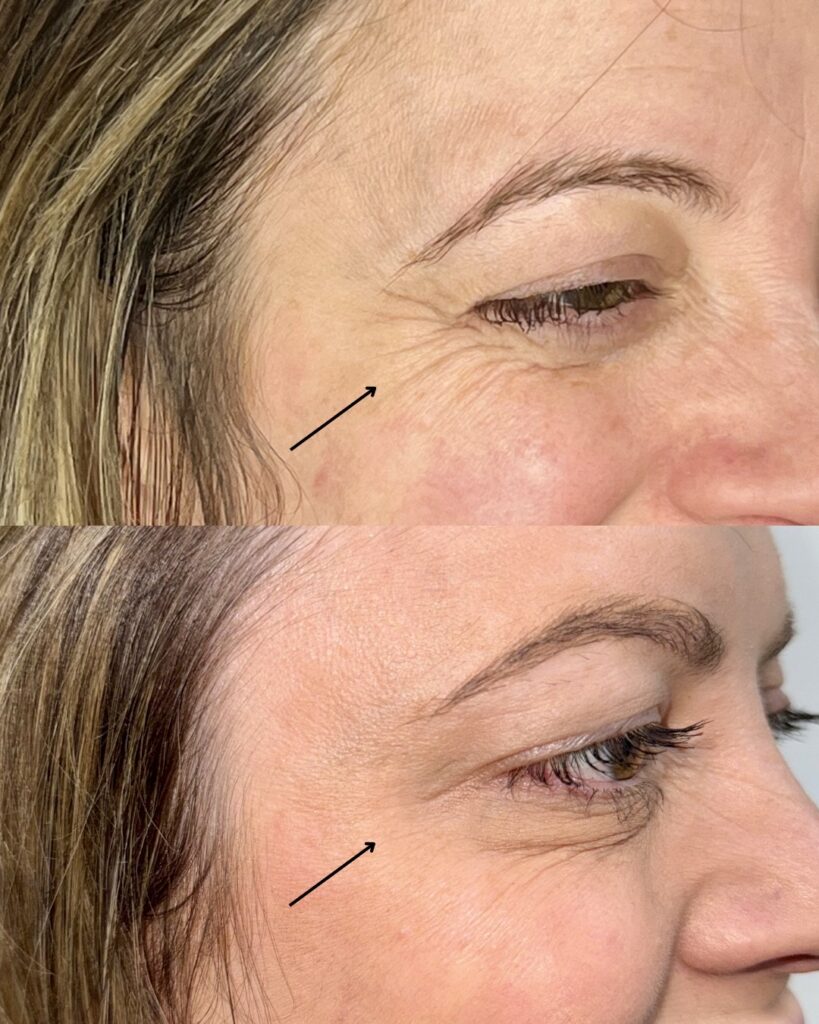 Untitled design Anelle Aesthetics Launches Exclusive Corporate Packages in Colmore Business District