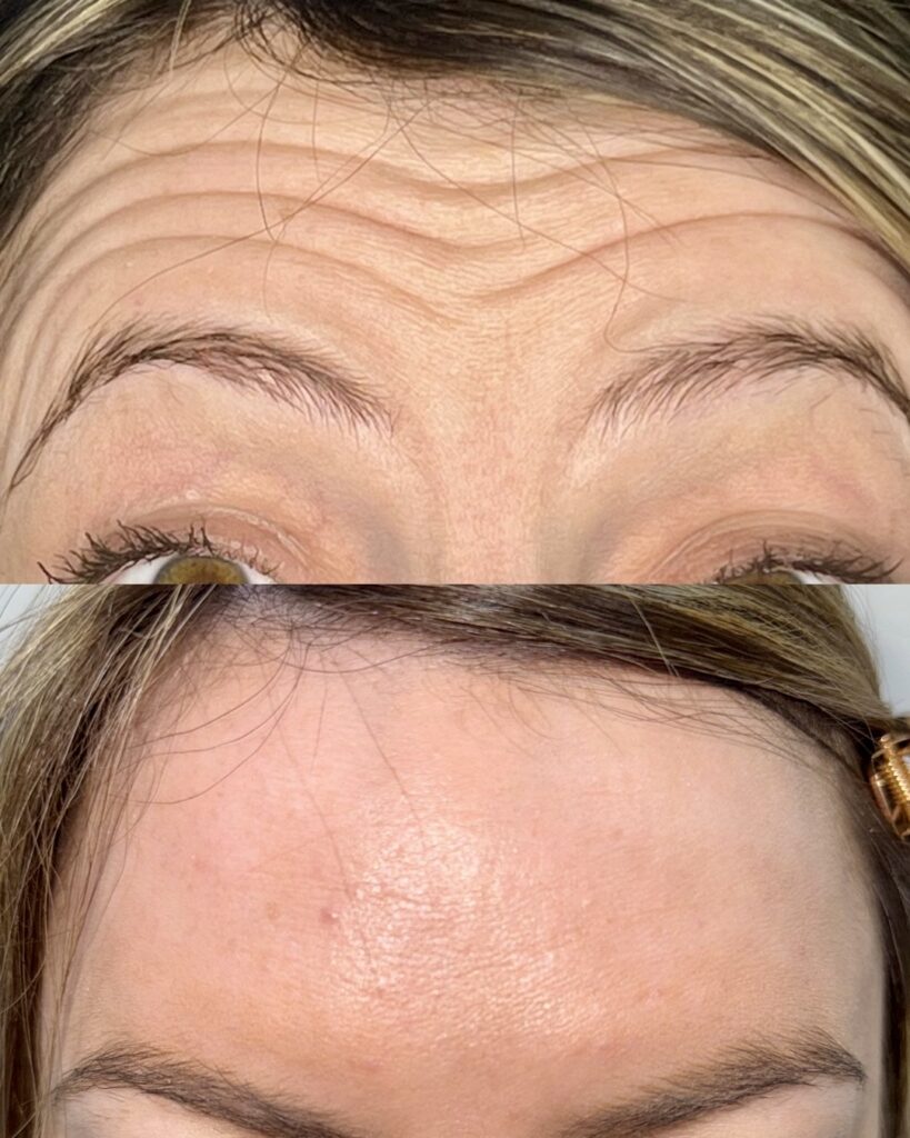 Untitled design56 Anelle Aesthetics Launches Exclusive Corporate Packages in Colmore Business District